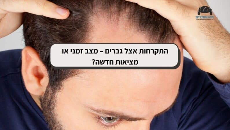 התקרחות אצל גברים