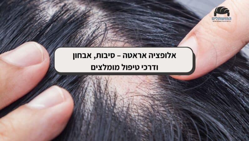 אלופציה אראטה