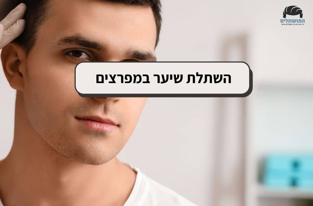 השתלת שיער במפרצים