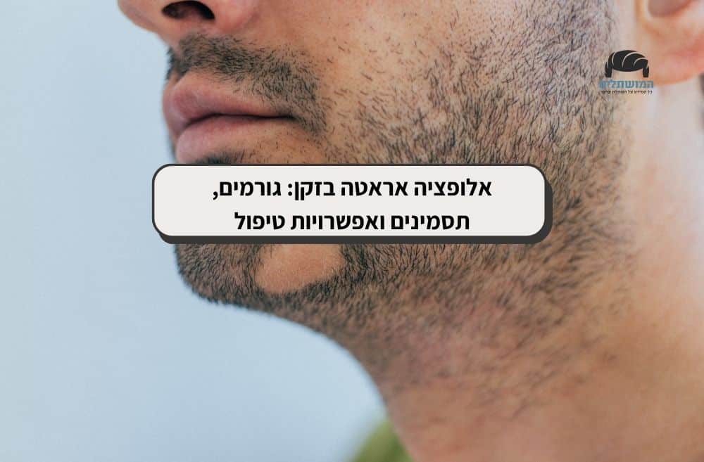 אלופציה אראטה בזקן