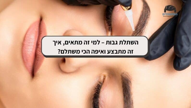 השתלת גבות