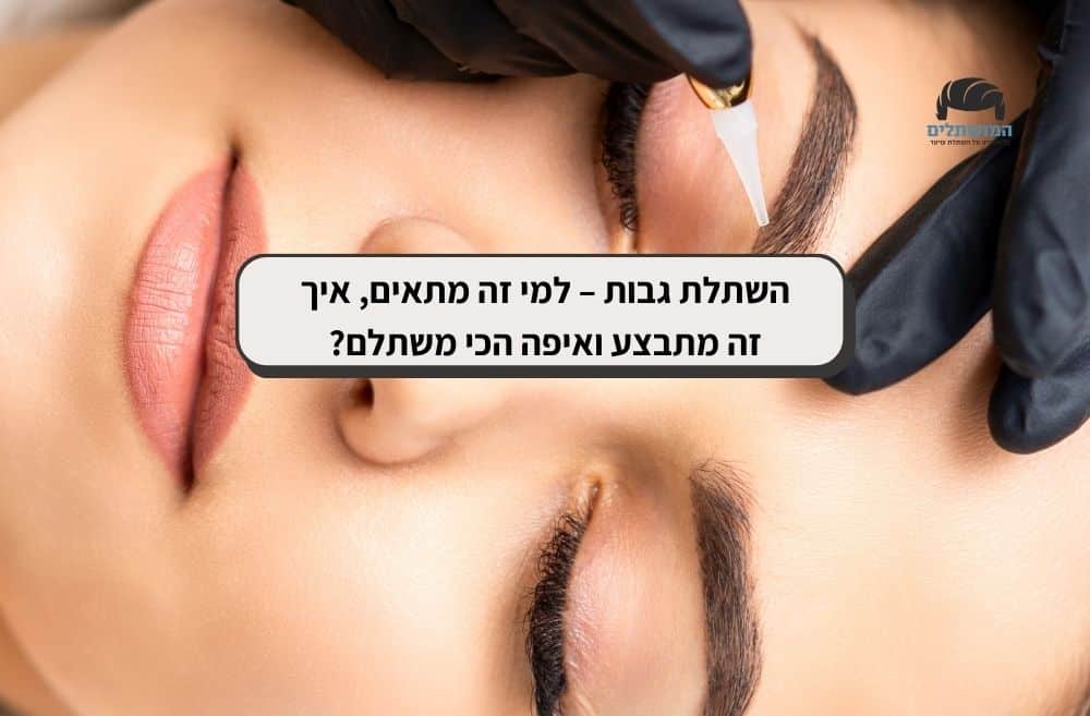 השתלת גבות