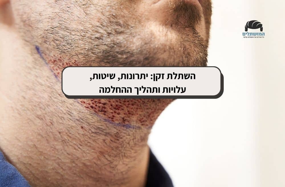 השתלת זקן