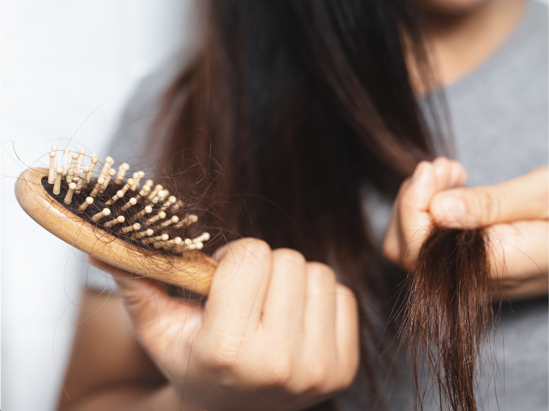 Hair loss during pregnancy